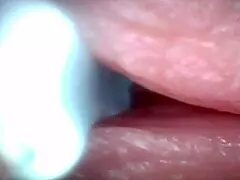 Hey, check out this endoscope camera catching the exact moment of male ejaculation